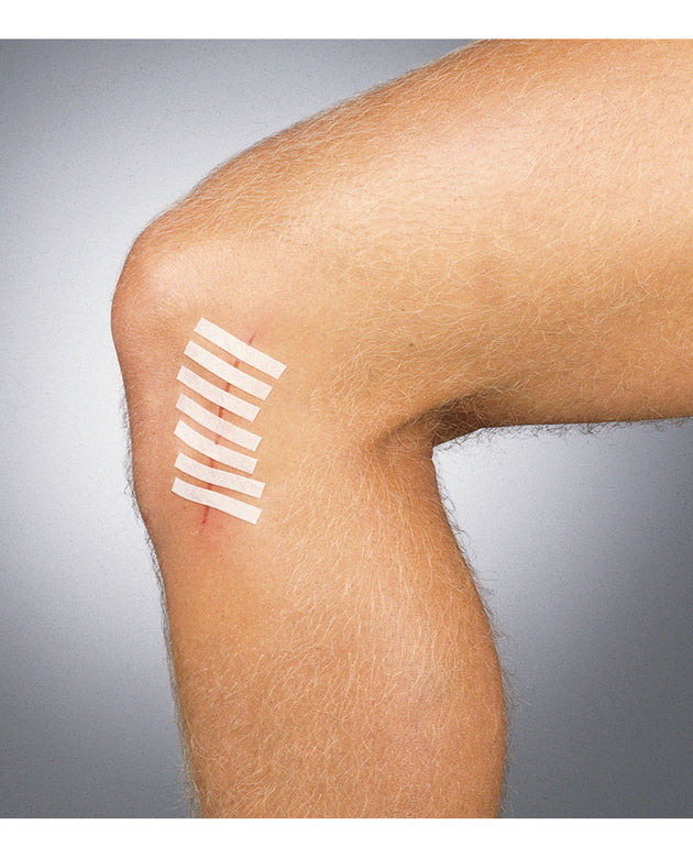 INTEGRA LIFESCIENCES SUTURE STRIP® WOUND CLOSURE STRIPS