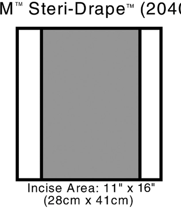 3M™ STERI-DRAPE™ 2 INCISE DRAPES