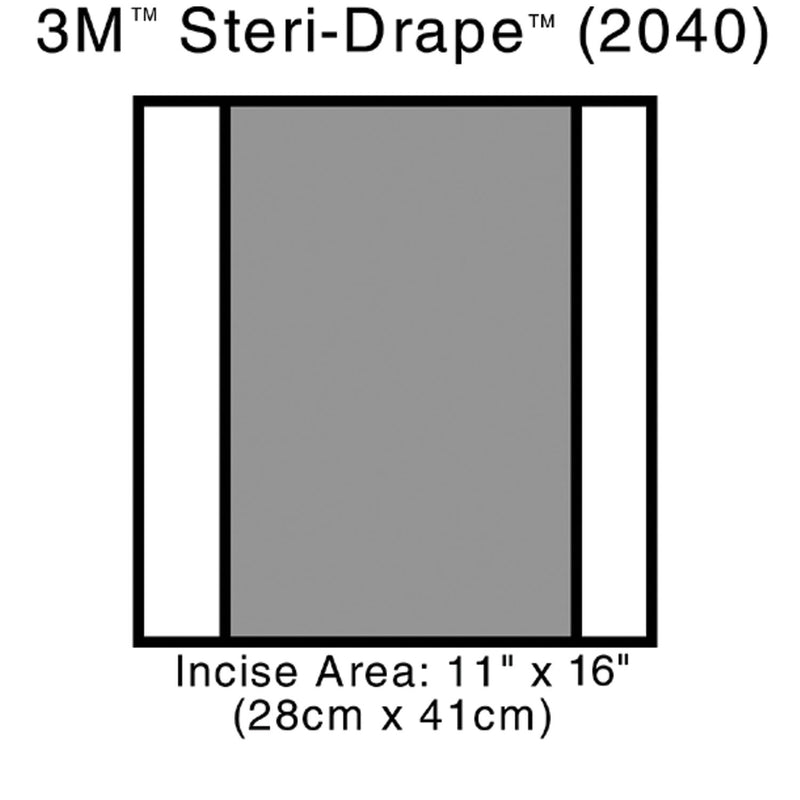 3M™ STERI-DRAPE™ 2 INCISE DRAPES