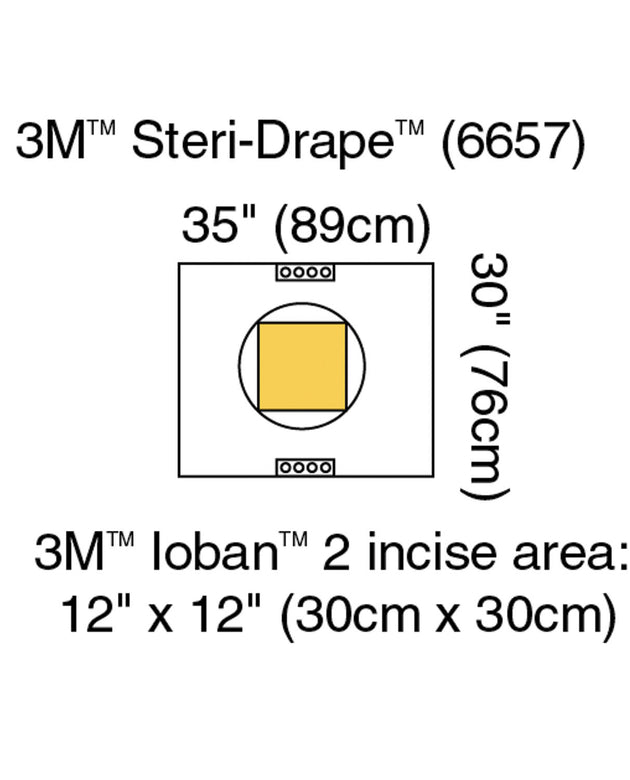 3M™ STERI-DRAPE™ CESAREAN-SECTION SHEETS & POUCHES