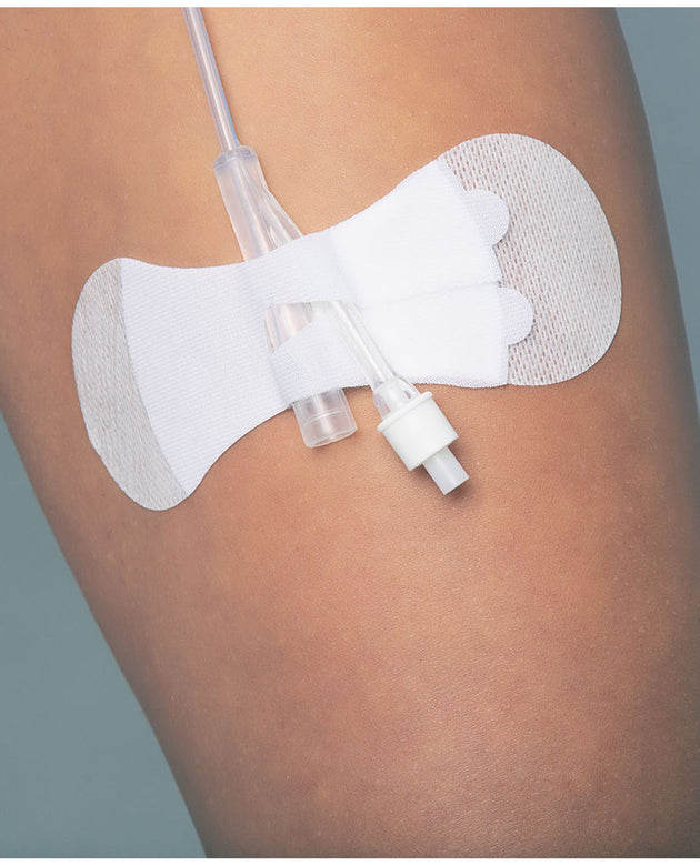 TIDI GRIP-LOK® FOLEY SECUREMENT DEVICE