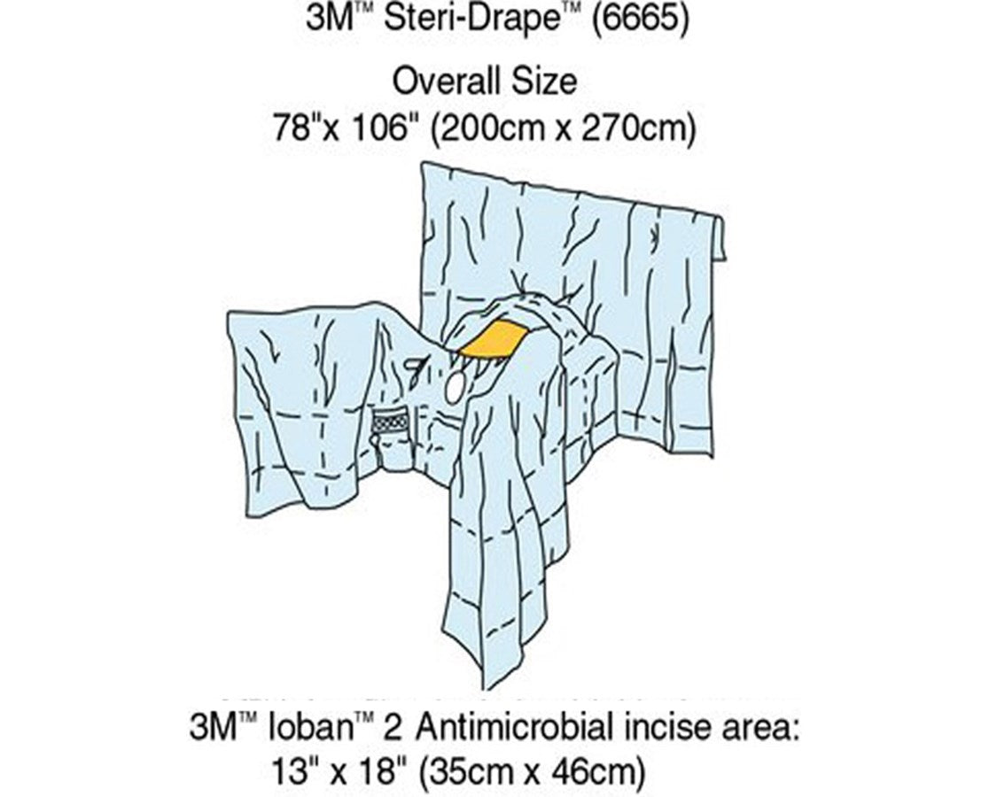 3M™ GENERAL SURGERY DRAPES