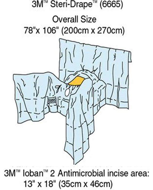 3M™ GENERAL SURGERY DRAPES