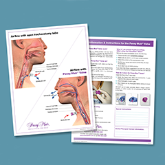 SPANISH PATIENT HANDOUT