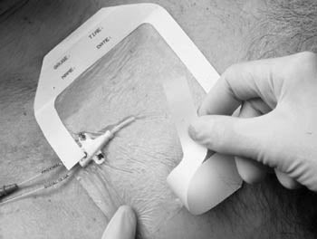3M™ TEGADERM™ TRANSPARENT FILM DRESSING