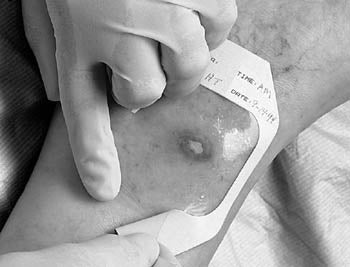 3M™ TEGADERM™ TRANSPARENT FILM DRESSING