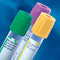 BD VACUTAINER® PLUS PLASTIC BLOOD COLLECTION TUBES (FLUORIDE GLUCOSE)