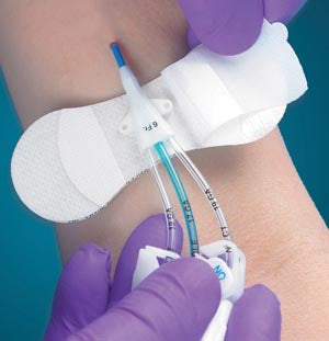 TIDI GRIP-LOK® PICC/CVC SECUREMENT DEVICE