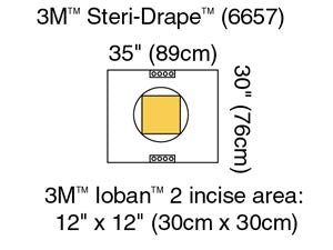 3M™ STERI-DRAPE™ CESAREAN-SECTION SHEETS & POUCHES