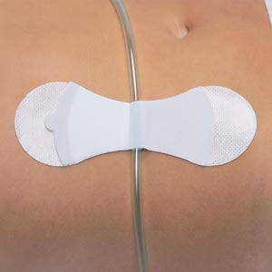 TIDI GRIP-LOK® UNIVERSAL SECUREMENT DEVICE