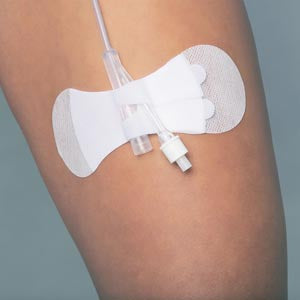 TIDI GRIP-LOK® FOLEY SECUREMENT DEVICE