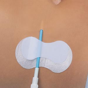 TIDI GRIP-LOK® PICC/CVC SECUREMENT DEVICE